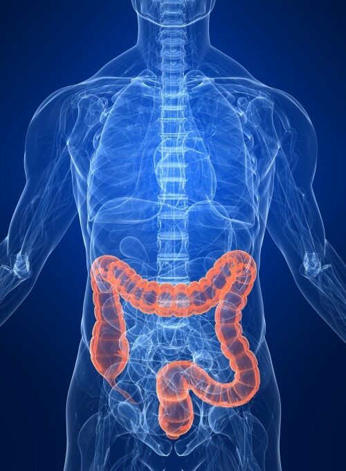 COLONSCOPIA VIRTUALE: NUOVE FRONTIERE DIAGNOSTICHE