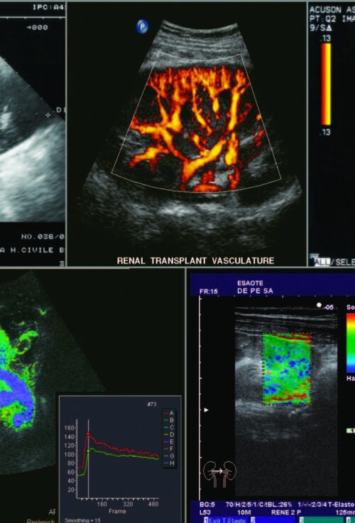 Corso Residenziale di Ecografia Clinica - Primo Livello