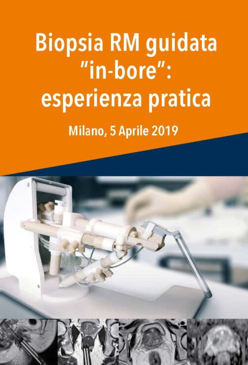 Biopsia RM guidata "in bore": esperienza pratica