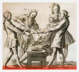 Il polso e la mano traumatici - III Corso di diagnosi e trattamento