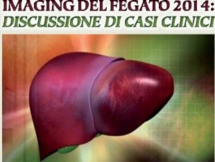 Imaging del fegato 2014: discussione di casi clinici