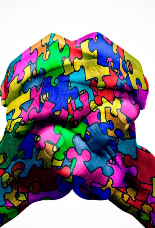 Neuropatie periferiche da intrappolamento dell'arto superiore: chirurgia e riabilitazione