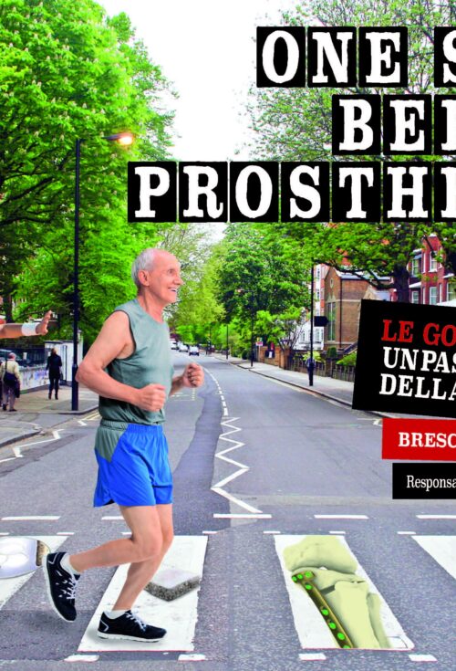 One Step before Prosthesis