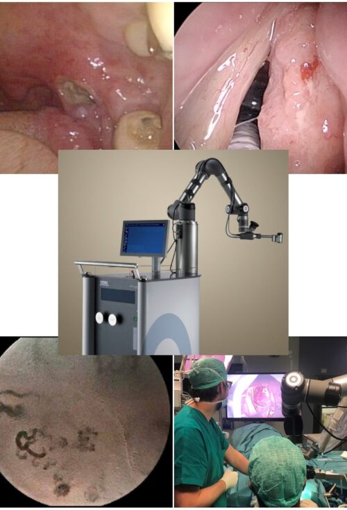 PRIMO CORSO DI ESOSCOPIA 3D IN CHIRURGIA TRANSORALE