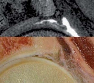 Resnick Course IX: MRI of the Joints