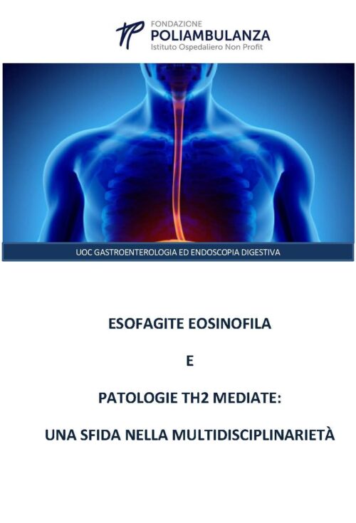 Esofagite eosinofila e patologie TH2 mediate